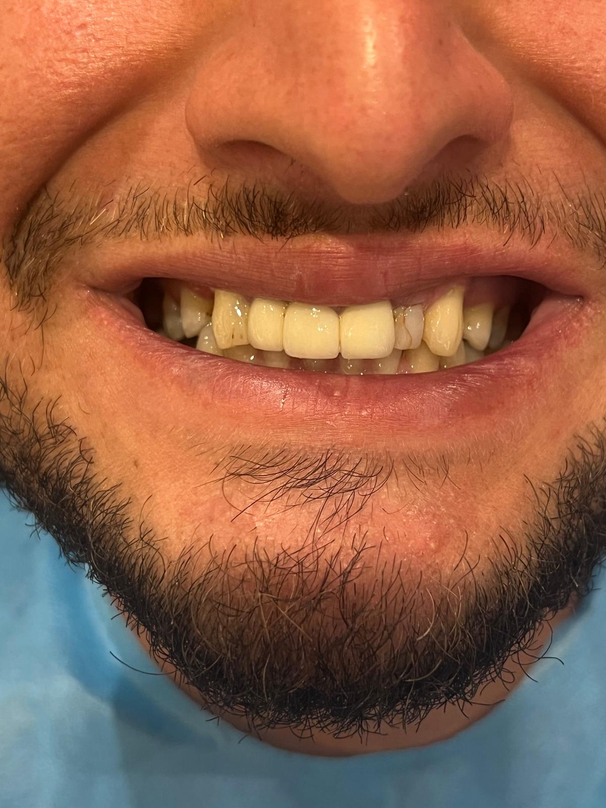 ECE Dental Patient Result